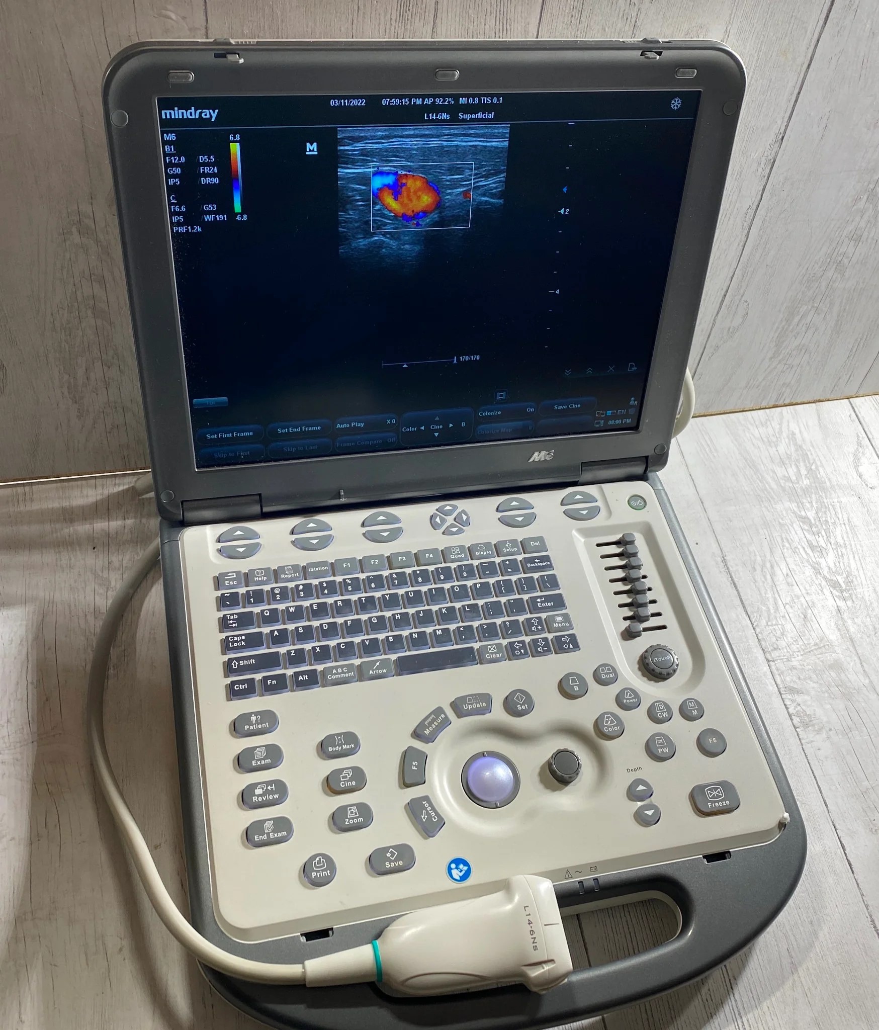 Mindray M6 Portable Ultrasound Machine - Image 2