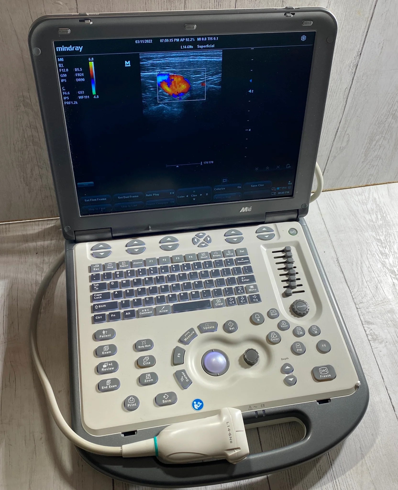 Mindray M6 Portable Ultrasound