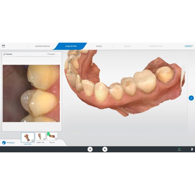 CEREC Primescan AC Dental Intraoral Scanner - Image 4
