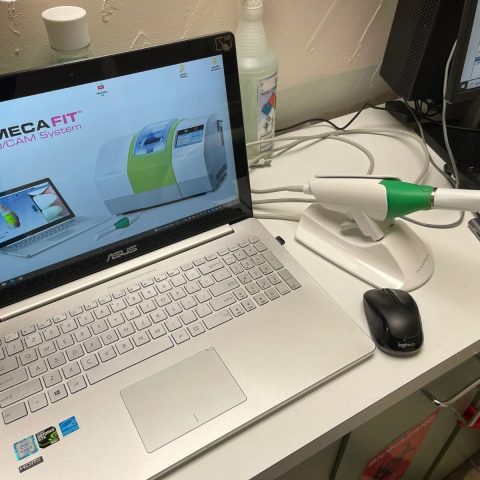 Planmeca Emerald Intraoral scanner
