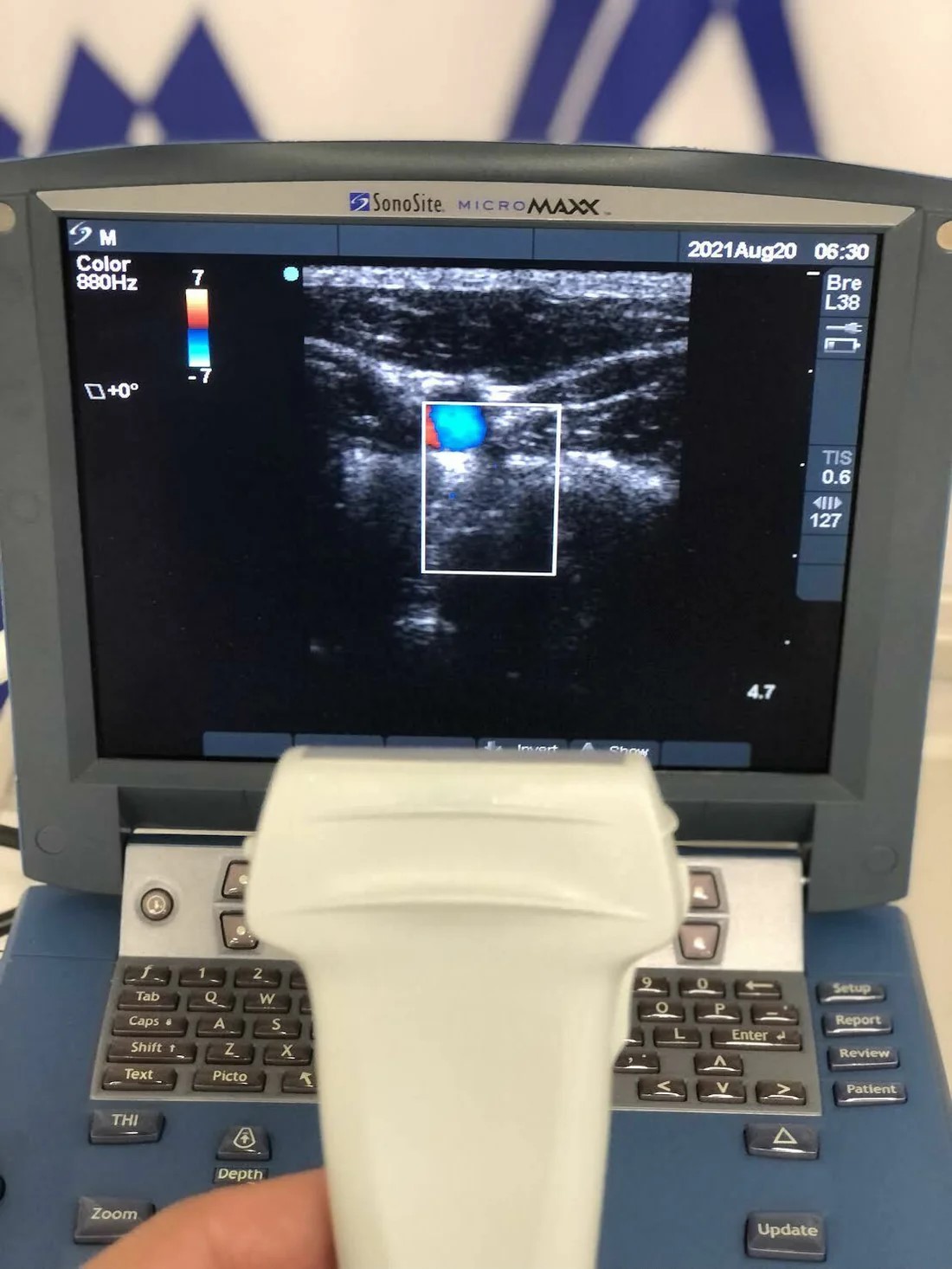 SonoSite MicroMaxx Ultrasound - Image 2