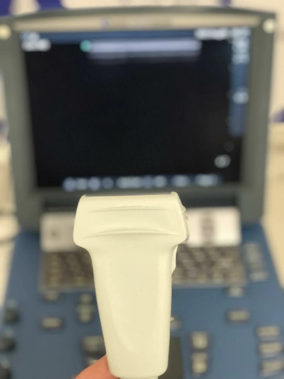 SonoSite MicroMaxx Ultrasound - Image 3